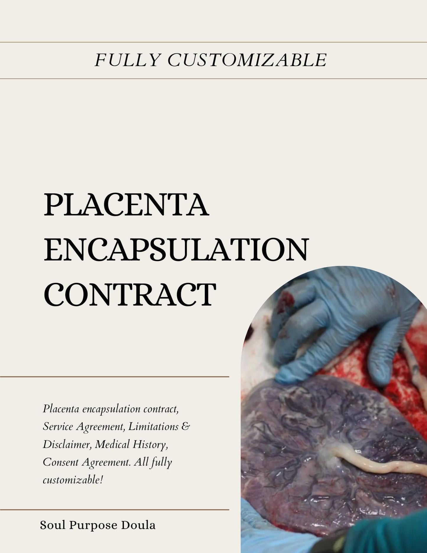 Placenta Encapsulation Contract & Handout Template, Editable Doula Forms, for Doulas, midwives, and placenta specialists